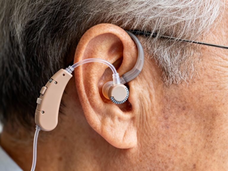 מחירי מכשירי שמיעה